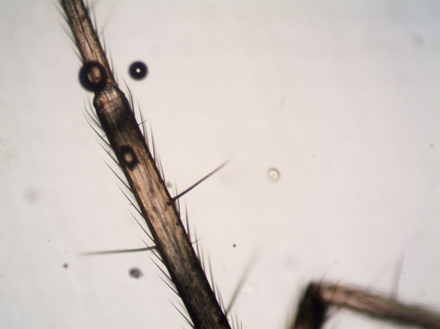 microscope view tardigrade eight legs closeup