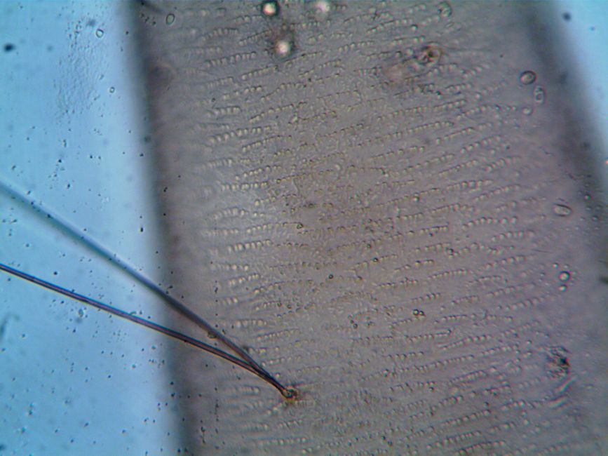 microscope view tardigrade curled survival cryptobiosis