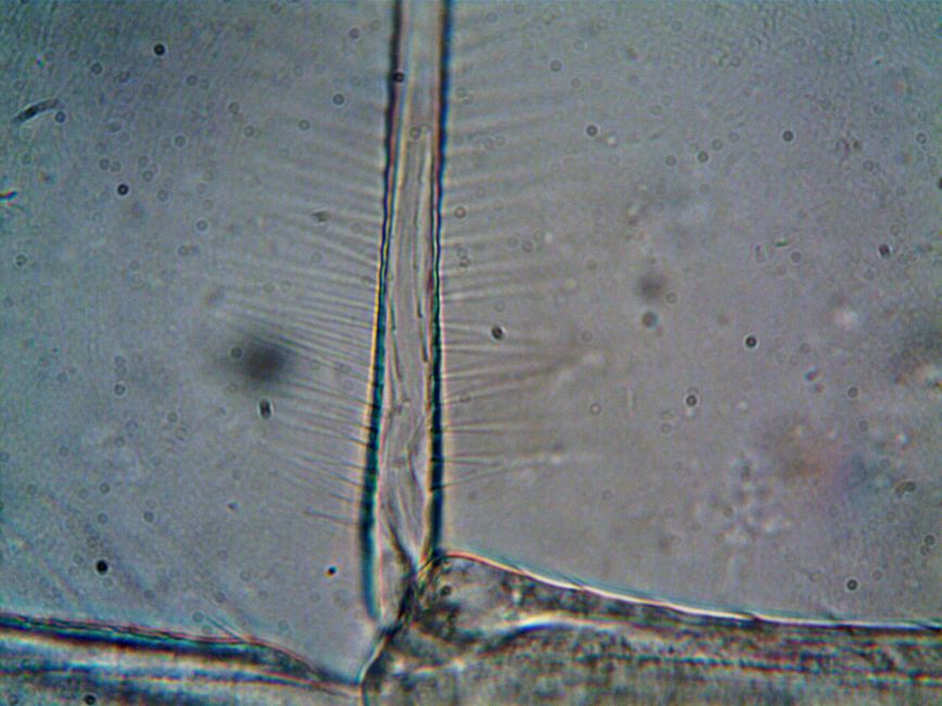microscope view tardigrade tun state curled